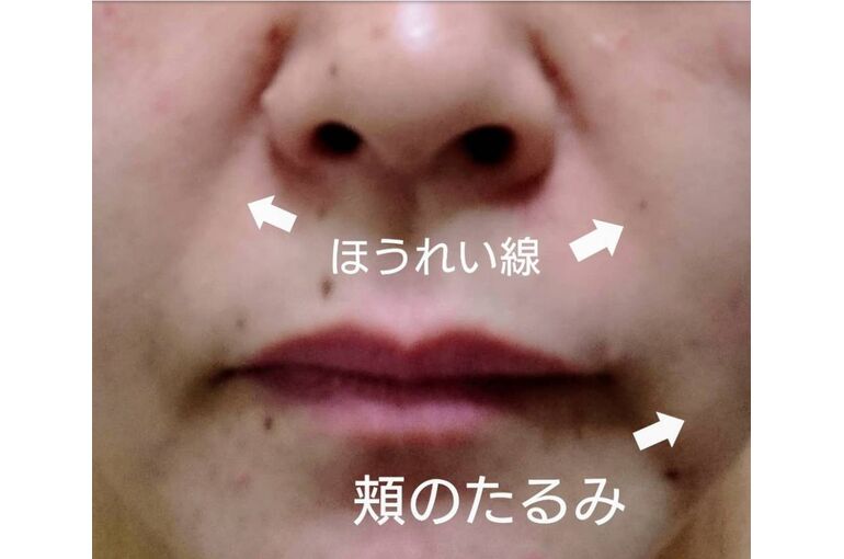6C5E3472-067E-43C6-9D42-07197249BE1E