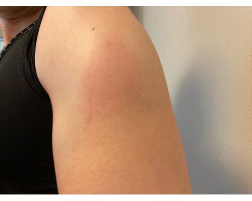 918D084C-7E34-420A-B7E0-C406187053D9